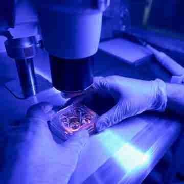 Celulas Madres Células madre: esperanza para epilepsia y diabetes