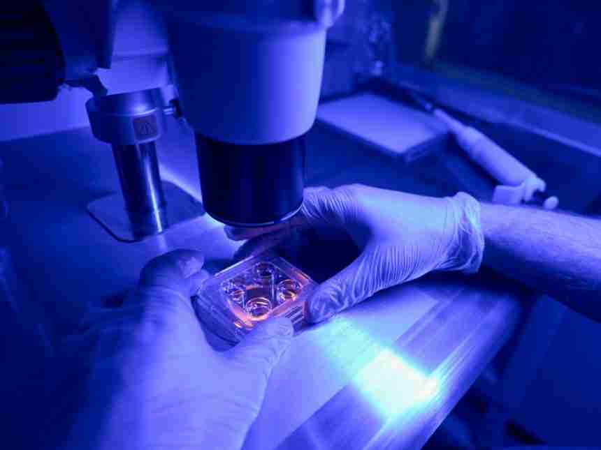 Células madre: esperanza para epilepsia y diabetes