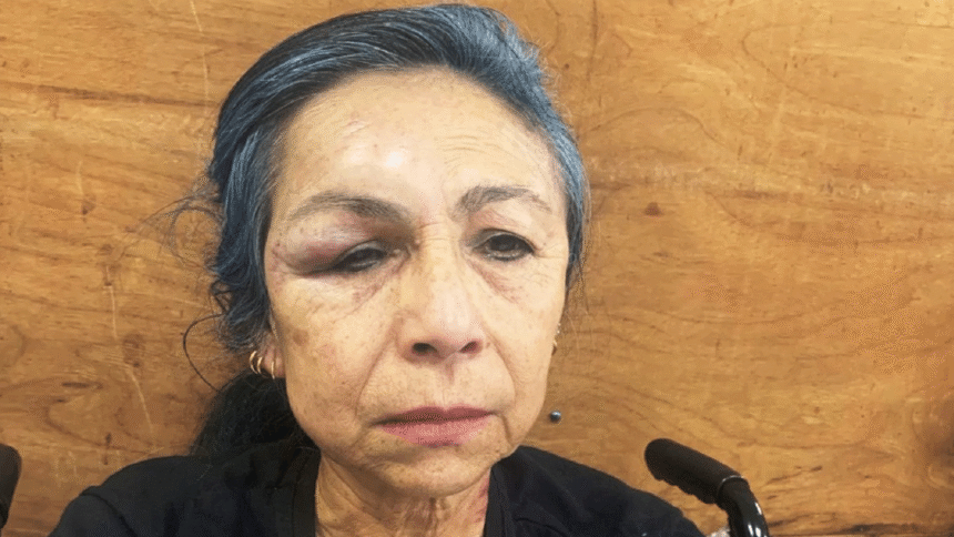 robo Enfermera es brutalmente golpeada durante asalto en Luque